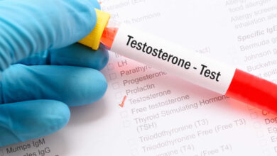 Como aumentar a testosterona de forma natural