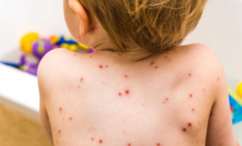 como tratar essa doença que pode ser grave?